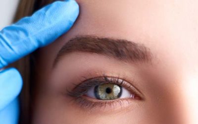 Lifting des sourcils : quelles cicatrices ?