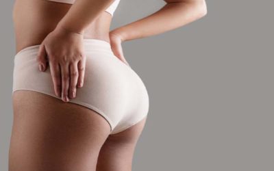 Quelles cicatrices après un lipofilling des fesses ?