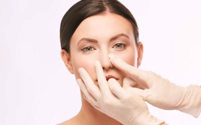 Rhinoplastie ultrasonique avant après : quel résultat ?