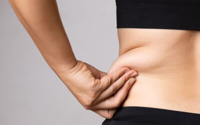 En quoi consiste une lipoaspiration du ventre ?