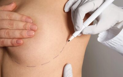 Après un lipofilling mammaire : quelle douleur ?