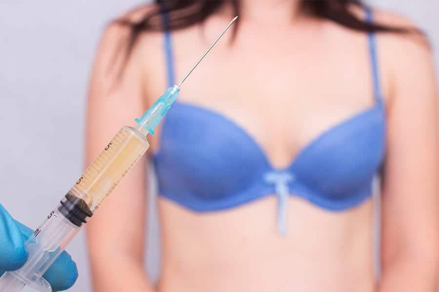 lipofilling anesthesie locale possible docteur frederic picard chirurgien esthetique paris levallois perret