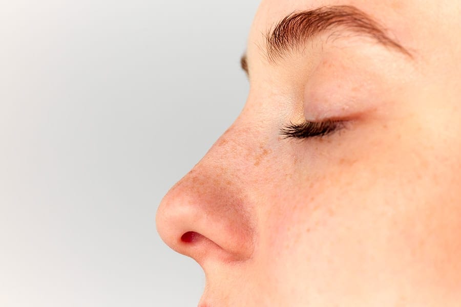 rhinoplastie convalescence operation nez dr frederic picard chirurgien esthetique chirurgie visage nez paris