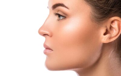 Rhinoplastie ultrasonique : à quoi s’attendre 3 semaines après l’intervention ?