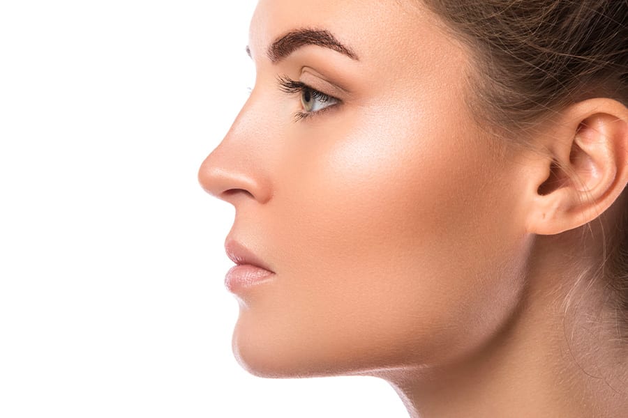 rhinoplastie ultrasonique 3 semaines apres intervention dr frederic picard chirurgien esthetique chirurgie visage nez paris