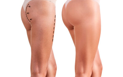 Comment avoir un BBL naturel ?